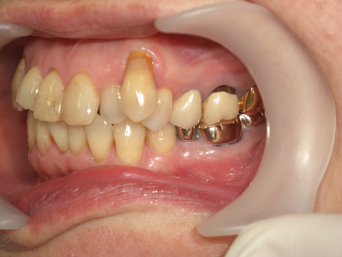 歯の位置と色が気になる症例2　術前