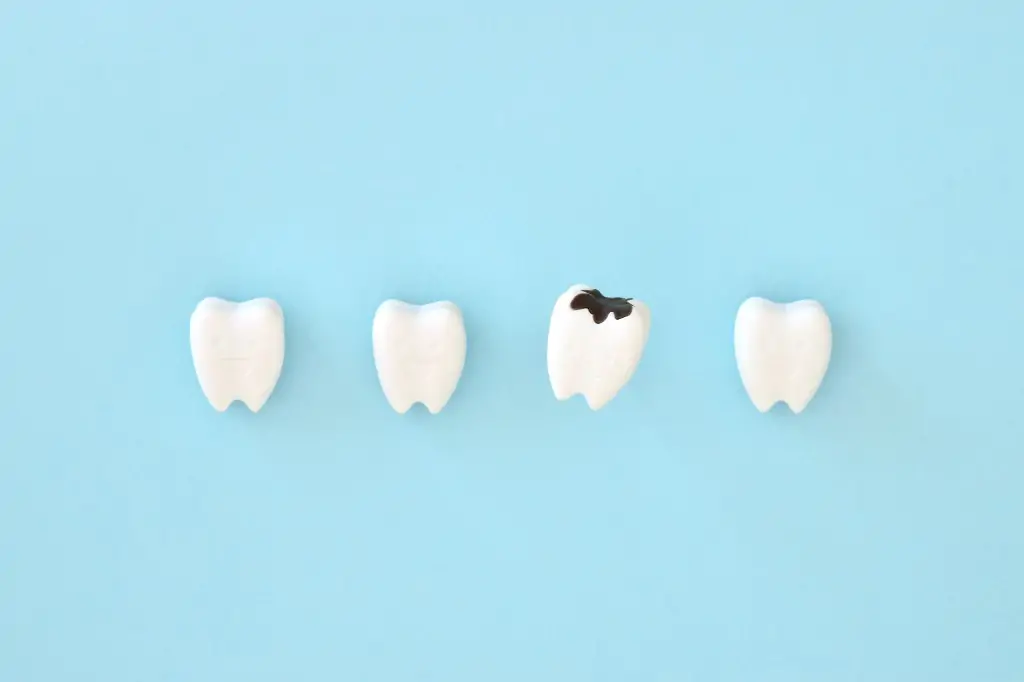 早期発見・早期治療で大切な歯を守る