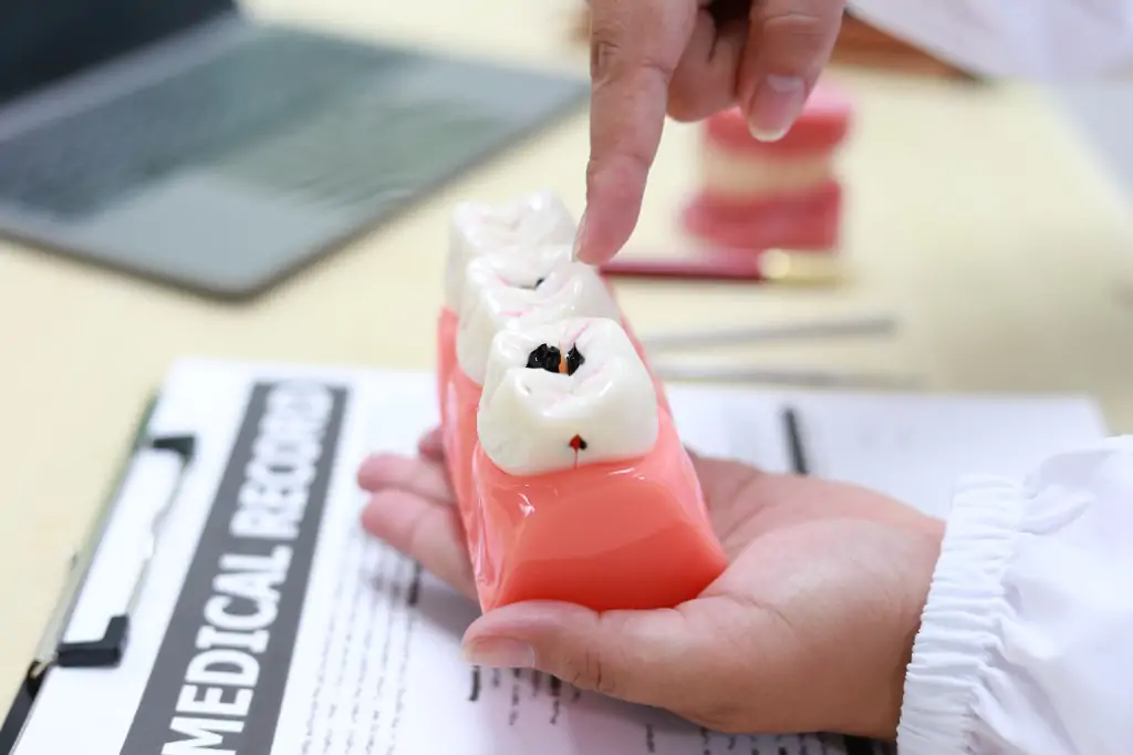 痛みに配慮した精密な虫歯治療