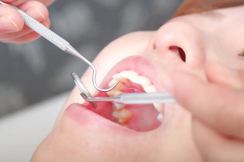 お口の健康を総合的にチェックする歯科ドック