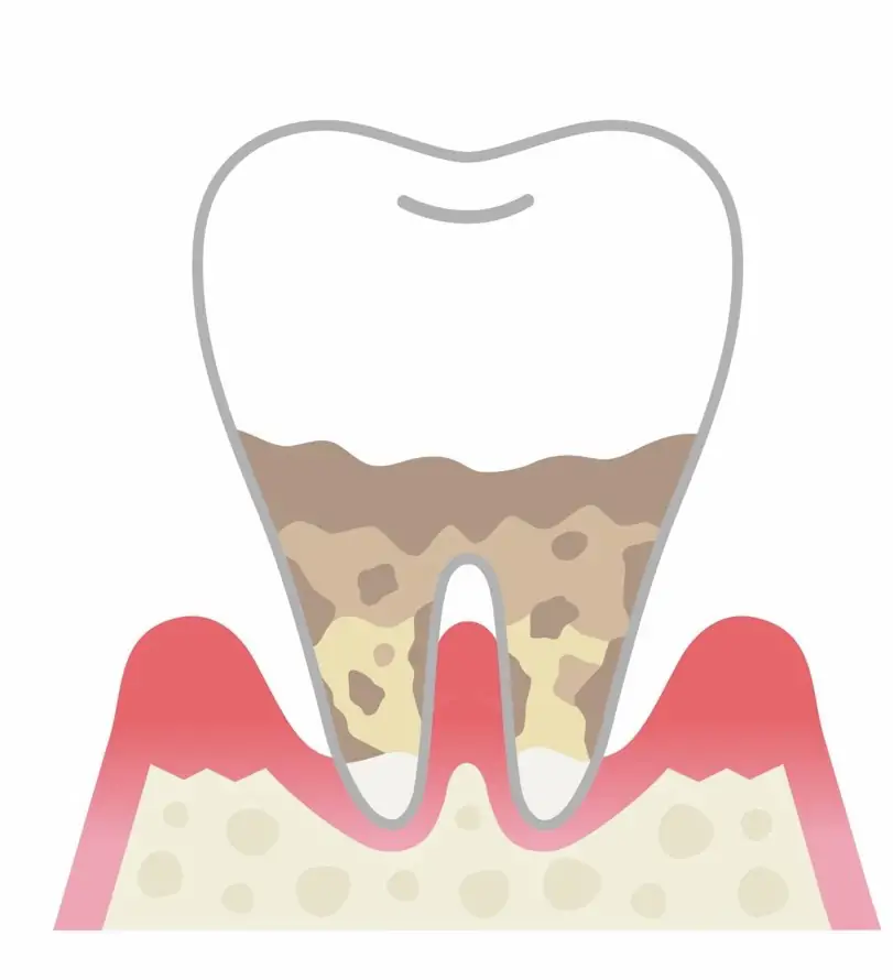 全身疾患との関連